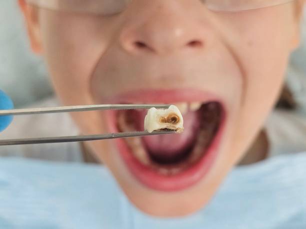 Best Emergency Pediatric Dentist  in Liberty, IN